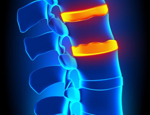 What is the difference between a slipped disc, bulging disc, herniated disc and a ruptured disc?